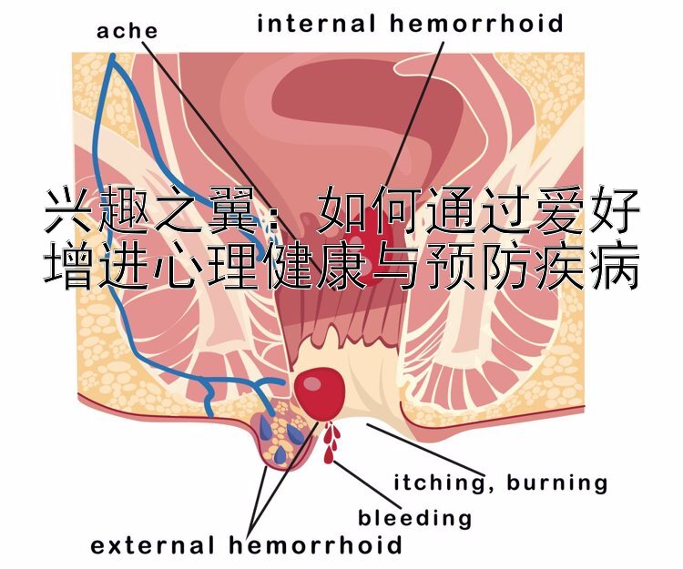 兴趣之翼：如何通过爱好增进心理健康与预防疾病