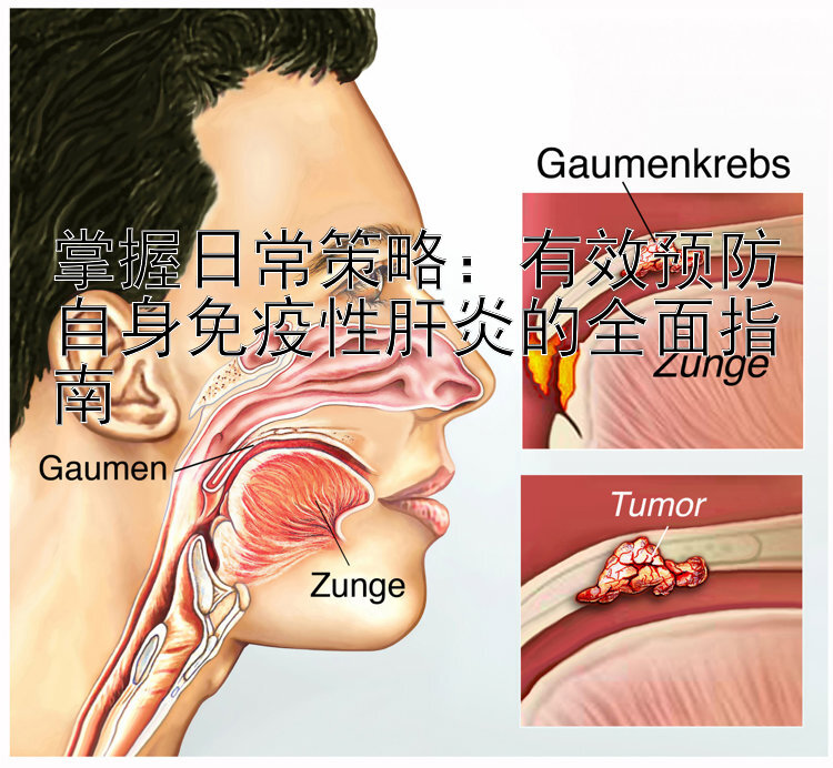 掌握日常策略：有效预防自身免疫性肝炎的全面指南