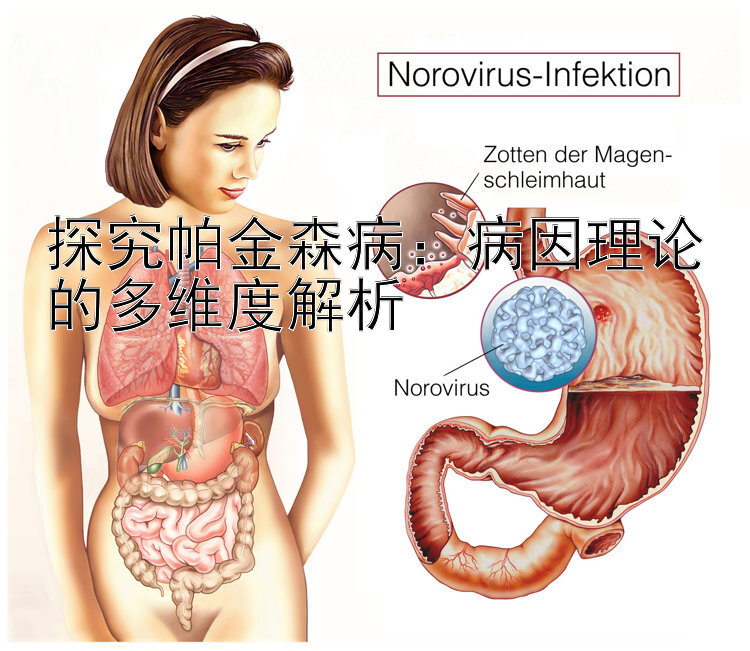 探究帕金森病：病因理论的多维度解析