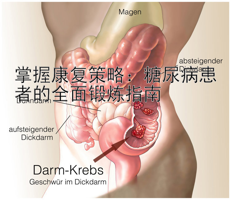 掌握康复策略：糖尿病患者的全面锻炼指南