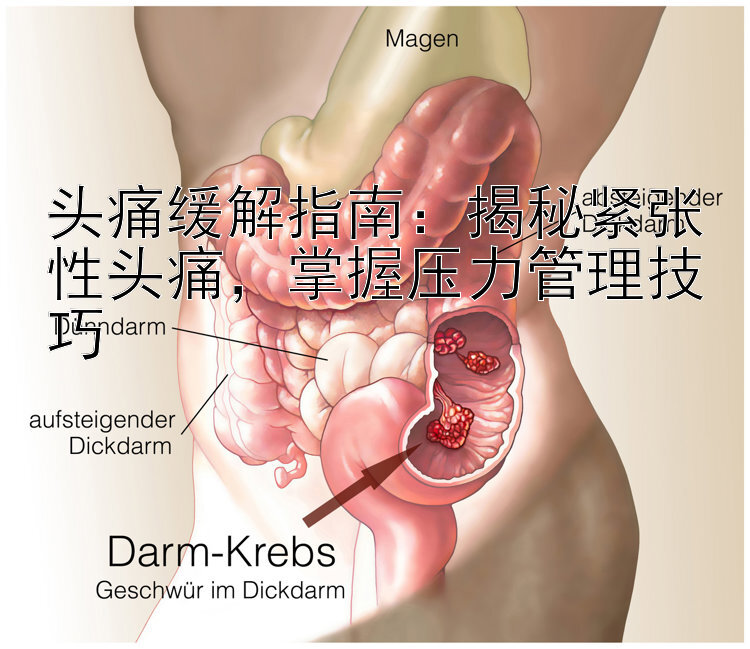 头痛缓解指南：揭秘紧张性头痛，掌握压力管理技巧