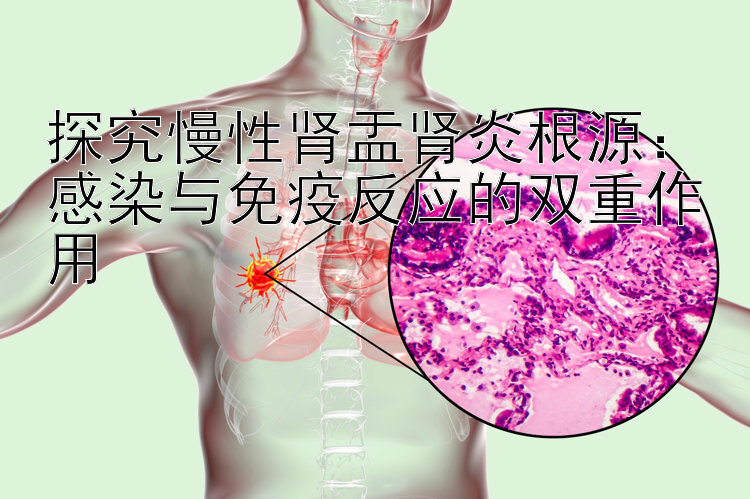 探究慢性肾盂肾炎根源：感染与免疫反应的双重作用