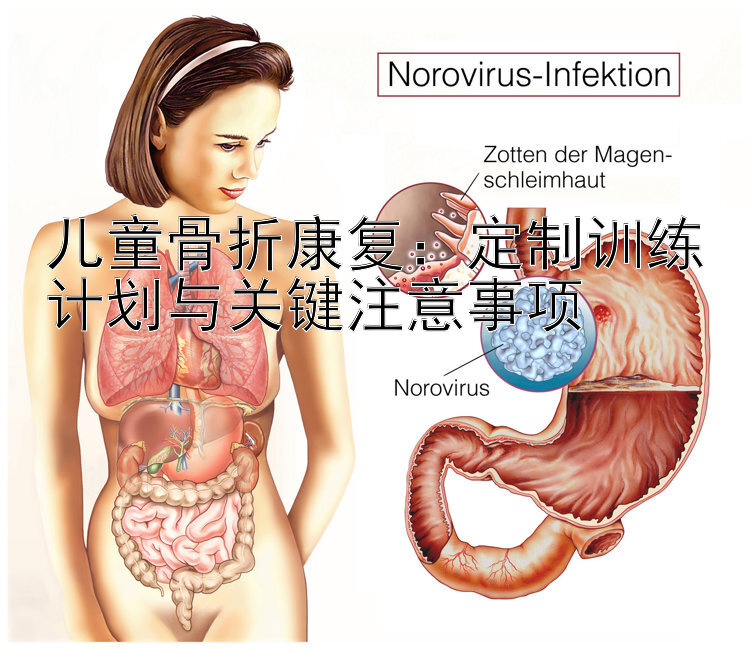 儿童骨折康复：定制训练计划与关键注意事项