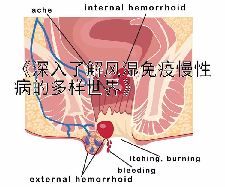 《深入了解风湿免疫慢性病的多样世界》