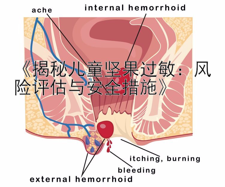 《揭秘儿童坚果过敏：风险评估与安全措施》