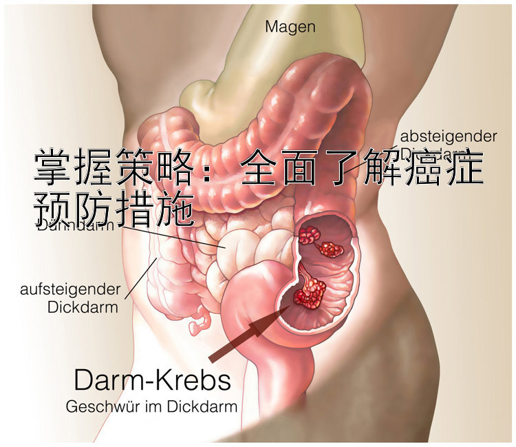 掌握策略：全面了解癌症预防措施