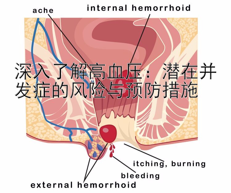 深入了解高血压：潜在并发症的风险与预防措施