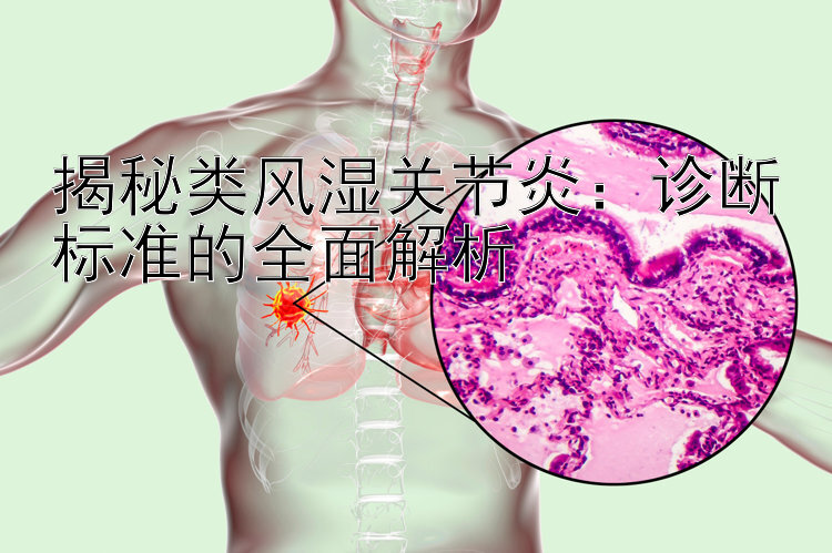 揭秘类风湿关节炎：诊断标准的全面解析