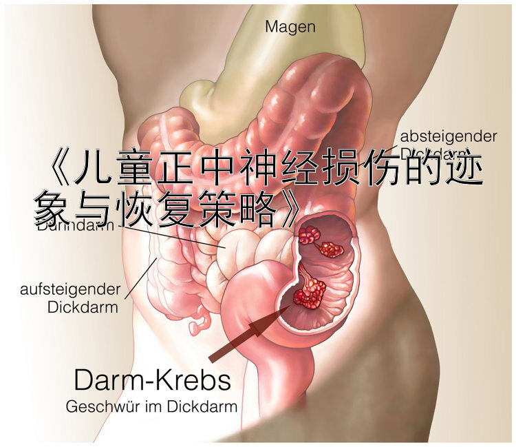 《儿童正中神经损伤的迹象与恢复策略》