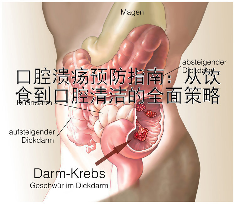 口腔溃疡预防指南：从饮食到口腔清洁的全面策略