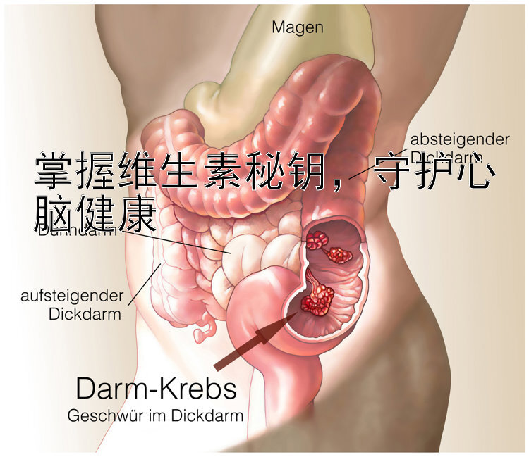 掌握维生素秘钥，守护心脑健康