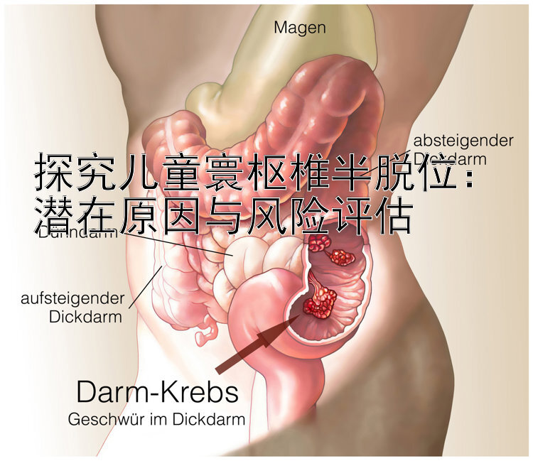 探究儿童寰枢椎半脱位：潜在原因与风险评估