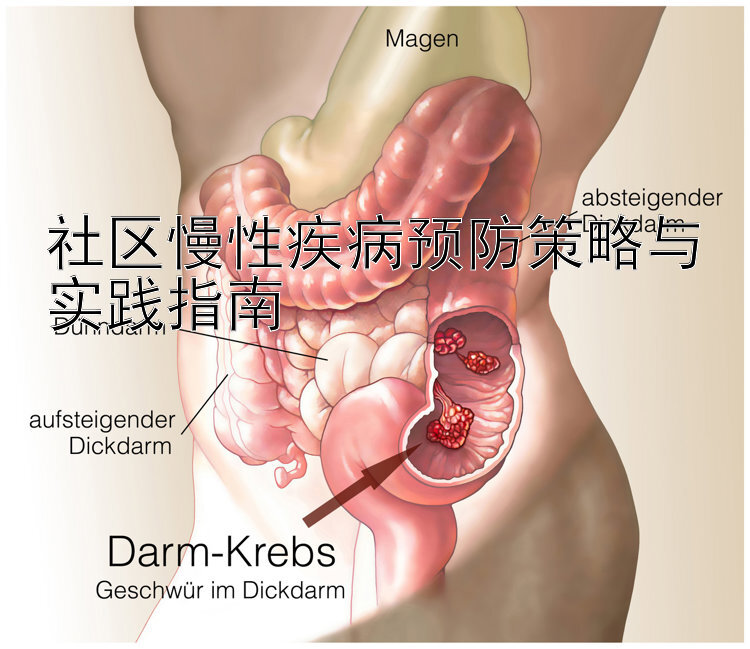 社区慢性疾病预防策略与实践指南