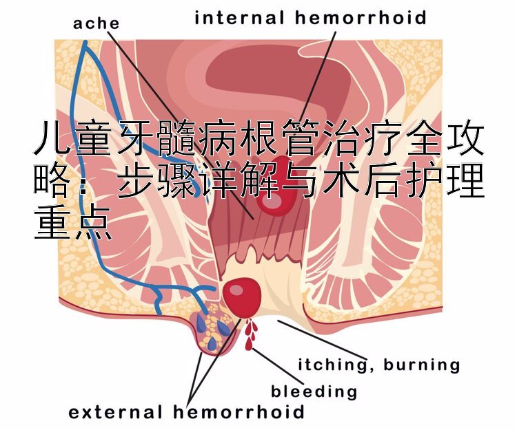 儿童牙髓病根管治疗全攻略：步骤详解与术后护理重点