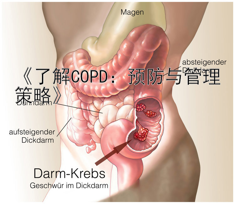 《了解COPD：预防与管理策略》