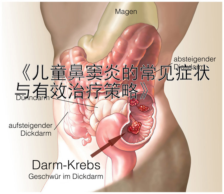 《儿童鼻窦炎的常见症状与有效治疗策略》