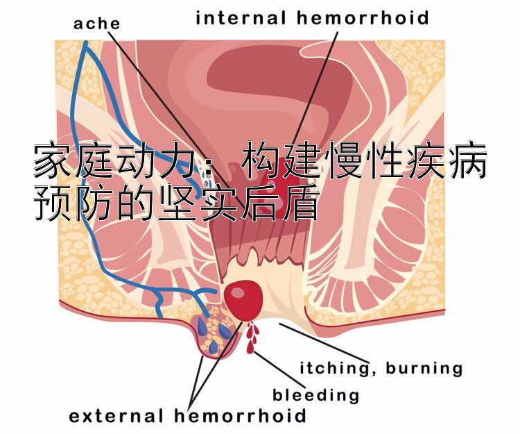 家庭动力：构建慢性疾病预防的坚实后盾