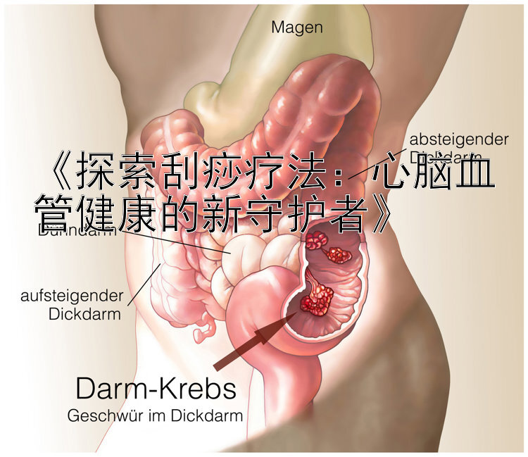 《探索刮痧疗法：心脑血管健康的新守护者》