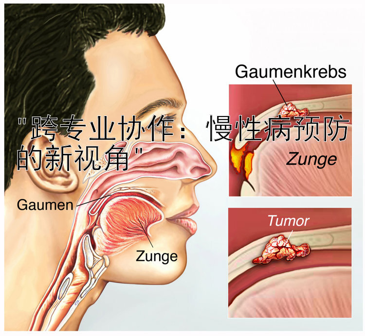 跨专业协作：慢性病预防的新视角