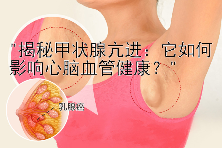 揭秘甲状腺亢进：它如何影响心脑血管健康？