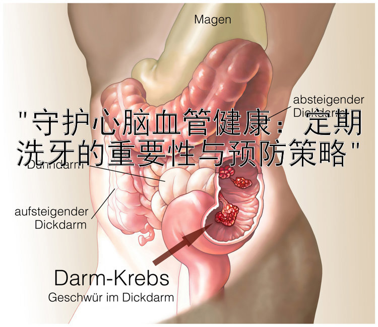 守护心脑血管健康：定期洗牙的重要性与预防策略