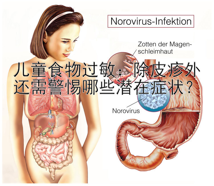 儿童食物过敏：除皮疹外还需警惕哪些潜在症状？