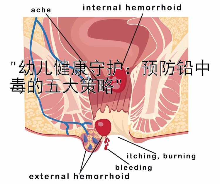 幼儿健康守护：预防铅中毒的五大策略