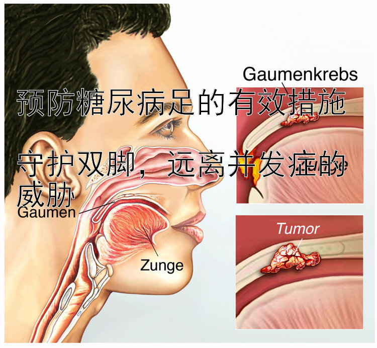 预防糖尿病足的有效措施  
守护双脚，远离并发症的威胁