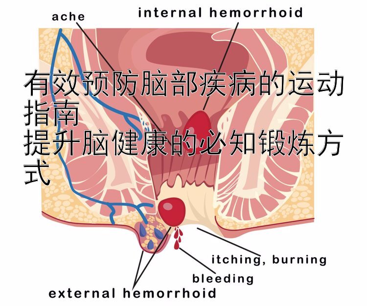 有效预防脑部疾病的运动指南  
提升脑健康的必知锻炼方式