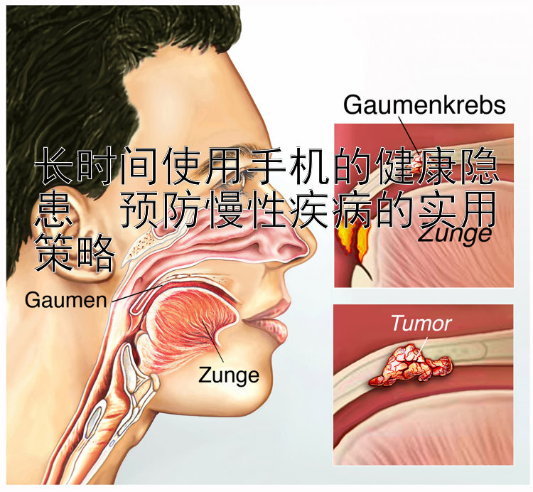 长时间使用手机的健康隐患  预防慢性疾病的实用策略