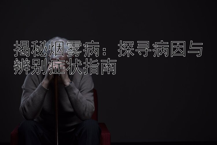 揭秘烟雾病：探寻病因与辨别症状指南