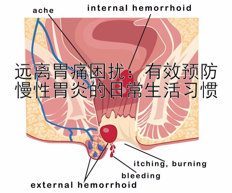 远离胃痛困扰：有效预防慢性胃炎的日常生活习惯