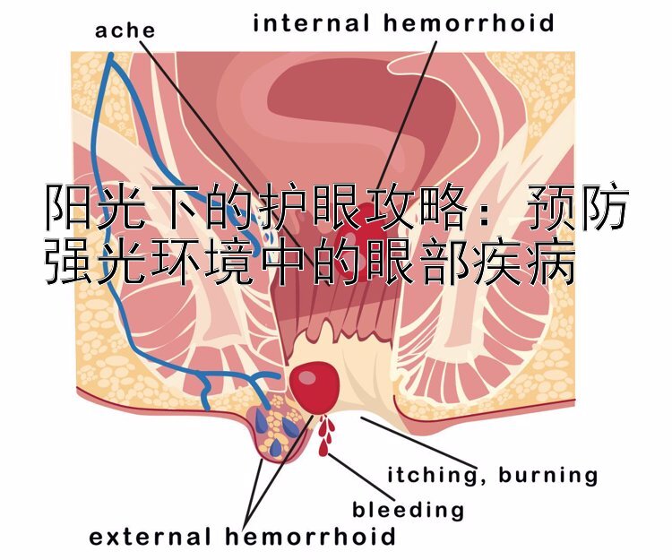 阳光下的护眼攻略：预防强光环境中的眼部疾病