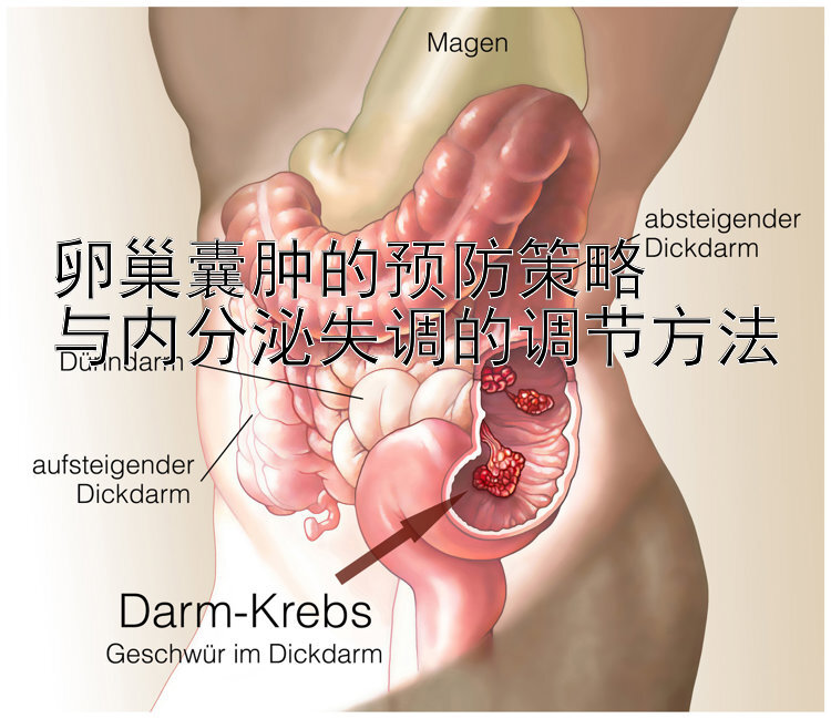 卵巢囊肿的预防策略  
与内分泌失调的调节方法