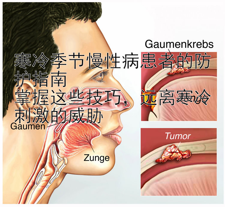 寒冷季节慢性病患者的防护指南  
掌握这些技巧，远离寒冷刺激的威胁