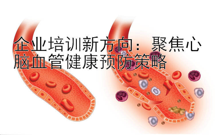 企业培训新方向：聚焦心脑血管健康预防策略