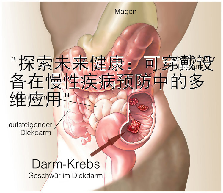 探索未来健康：可穿戴设备在慢性疾病预防中的多维应用